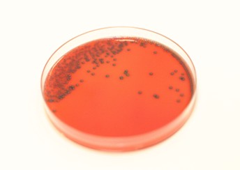 Gratis webinar om Listeria 16.desember kl. 09-10